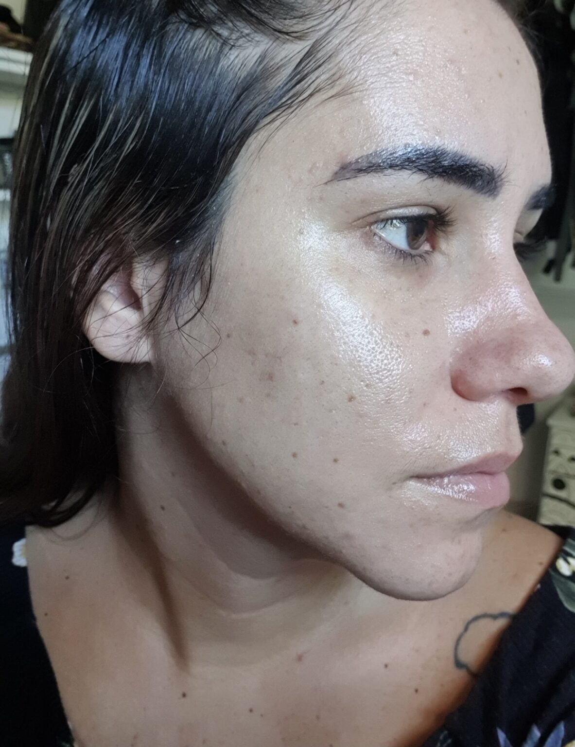 MEUS PRODUTOS DE SKIN CARE PARA O DIA - ROSTO COM ACNE